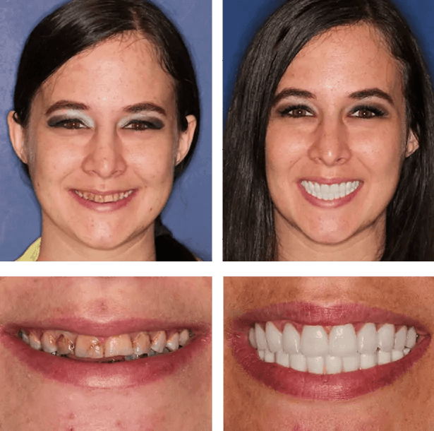 Jackie's before after image