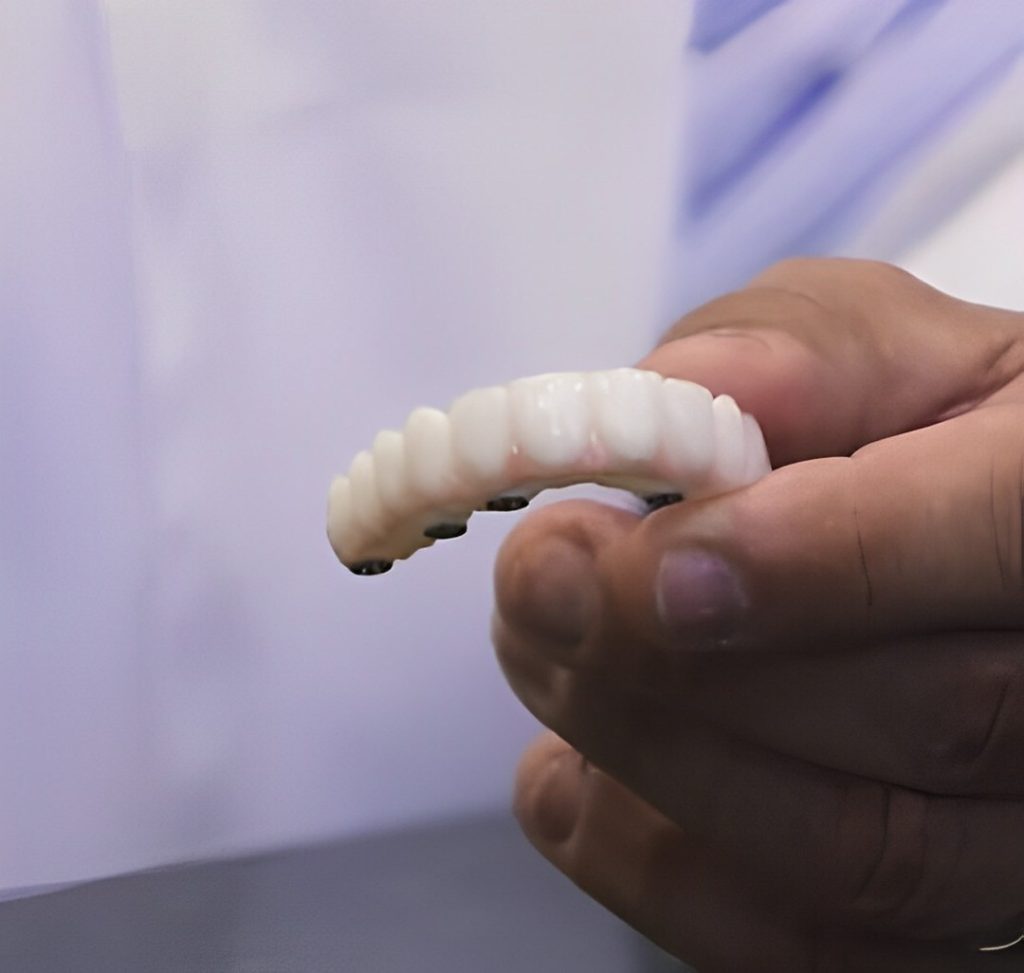 a beautiful new set of teeth