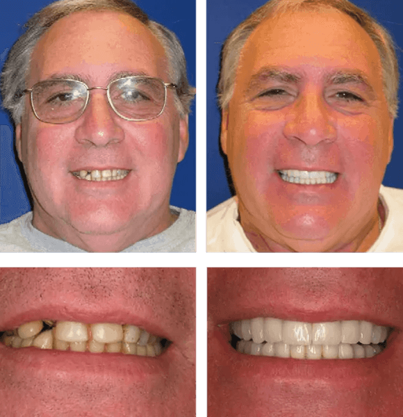 why you might need teeth next day® solutions