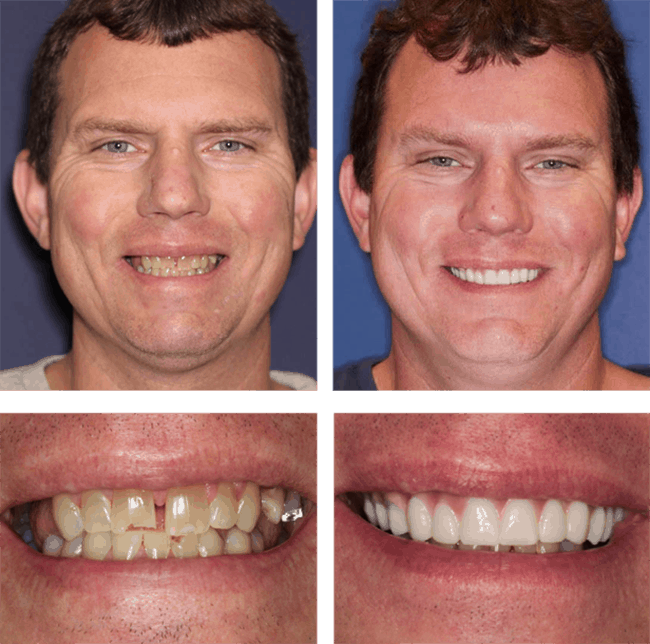 Jerry's before after image