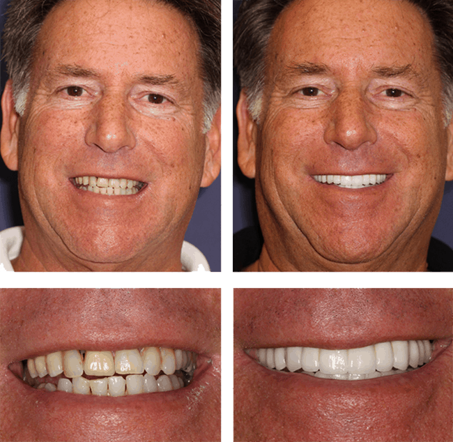 Lenny's before after image